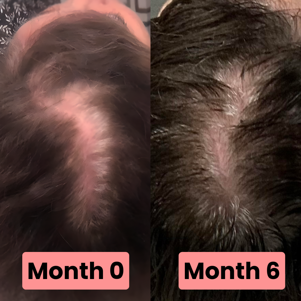 Vitamin Drops + Growth Serum Refill
