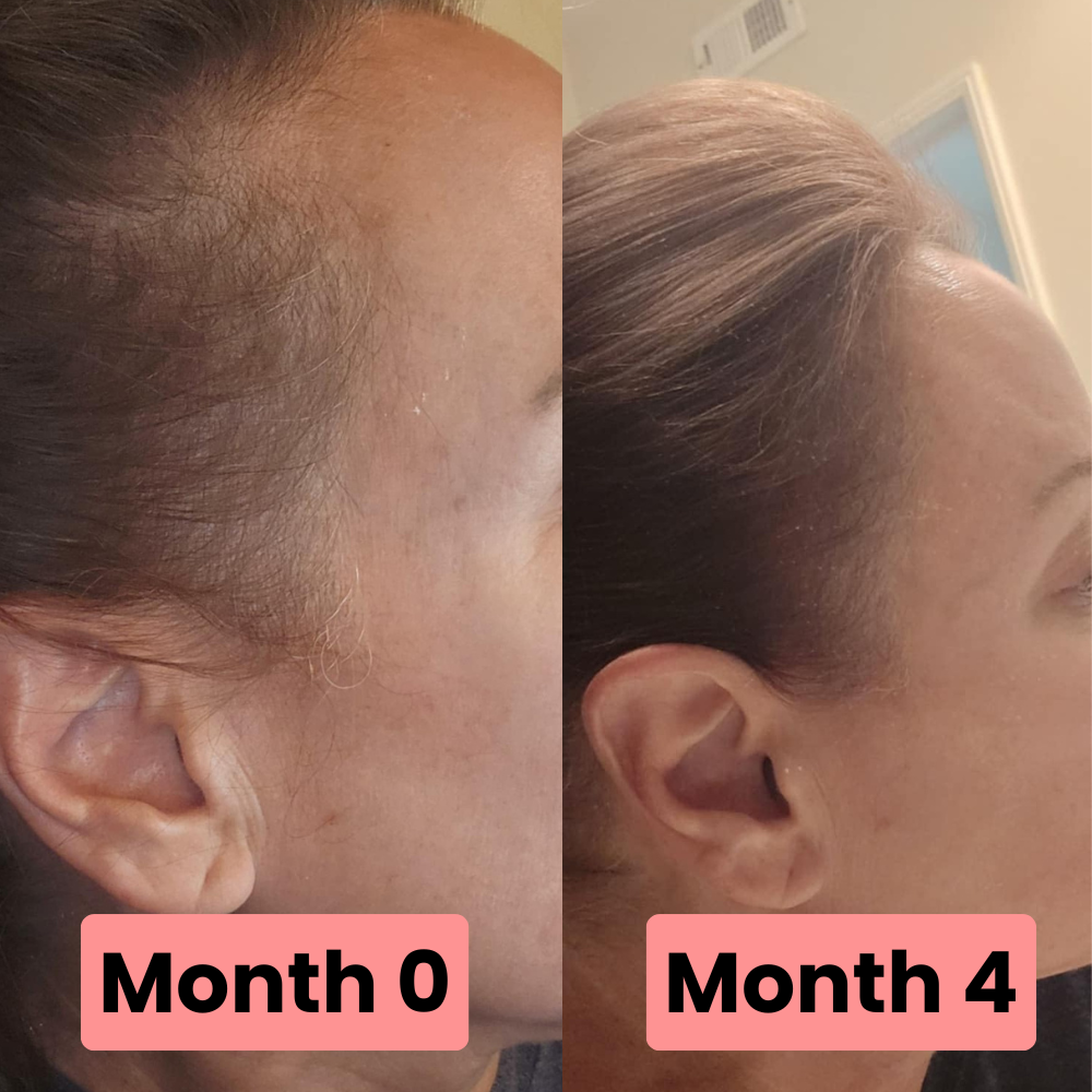 Vitamin Drops + Growth Serum Refill
