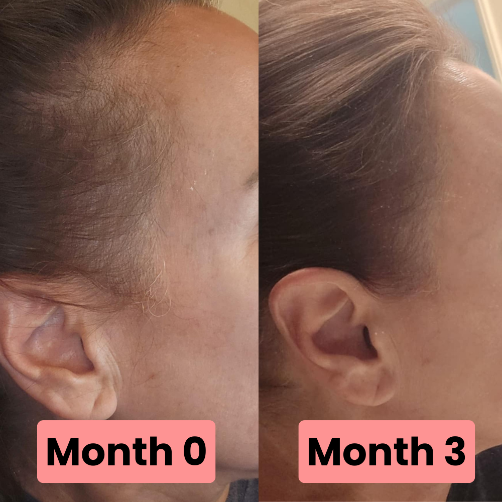 Rivela™ Liquid Hair Growth Vitamins