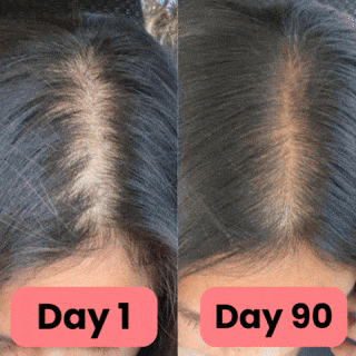 The Regrow Pro